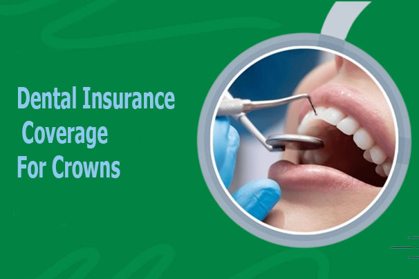 Dental Insurance Coverage for Crowns